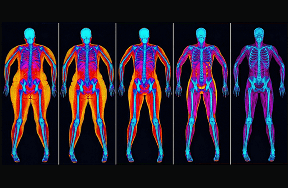 Visceral Fat Measurement